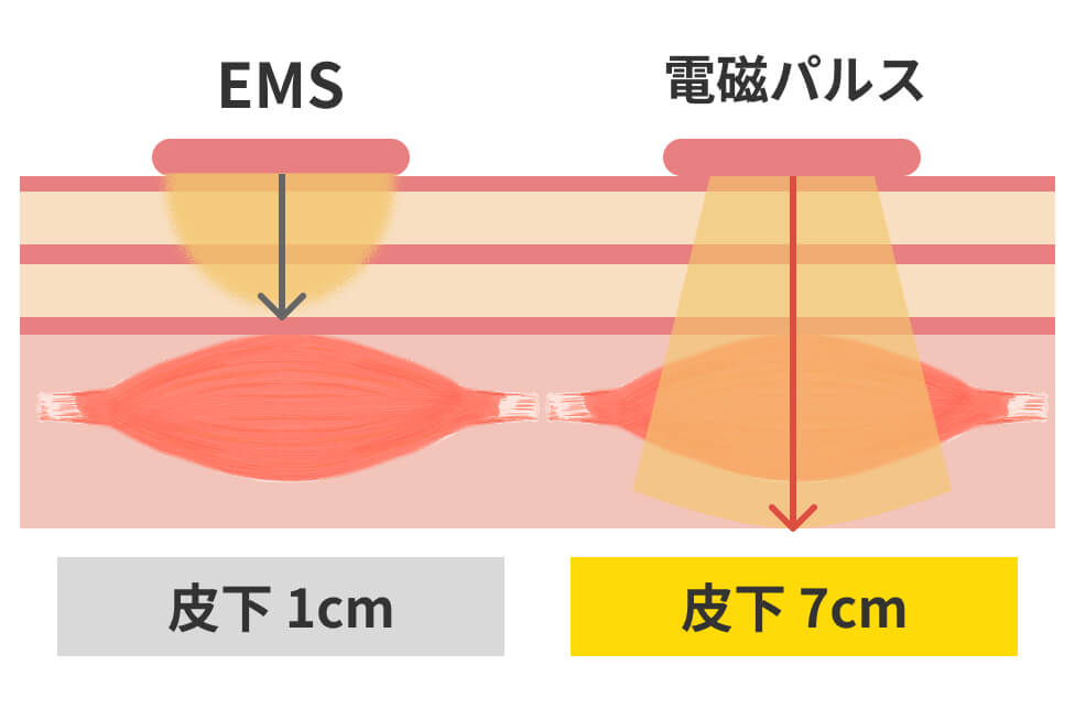 EMSと電磁パルス痩身の作用の違いを比較した図。EMSは皮下1cmまで、電磁パルスは皮下7cmまで届く。